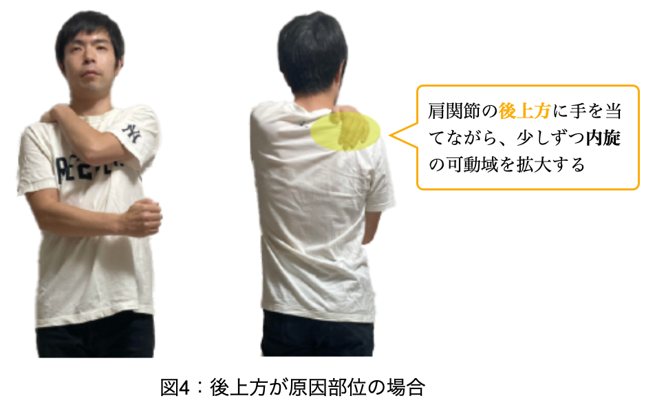 肩関節の後上方の硬さの評価方法