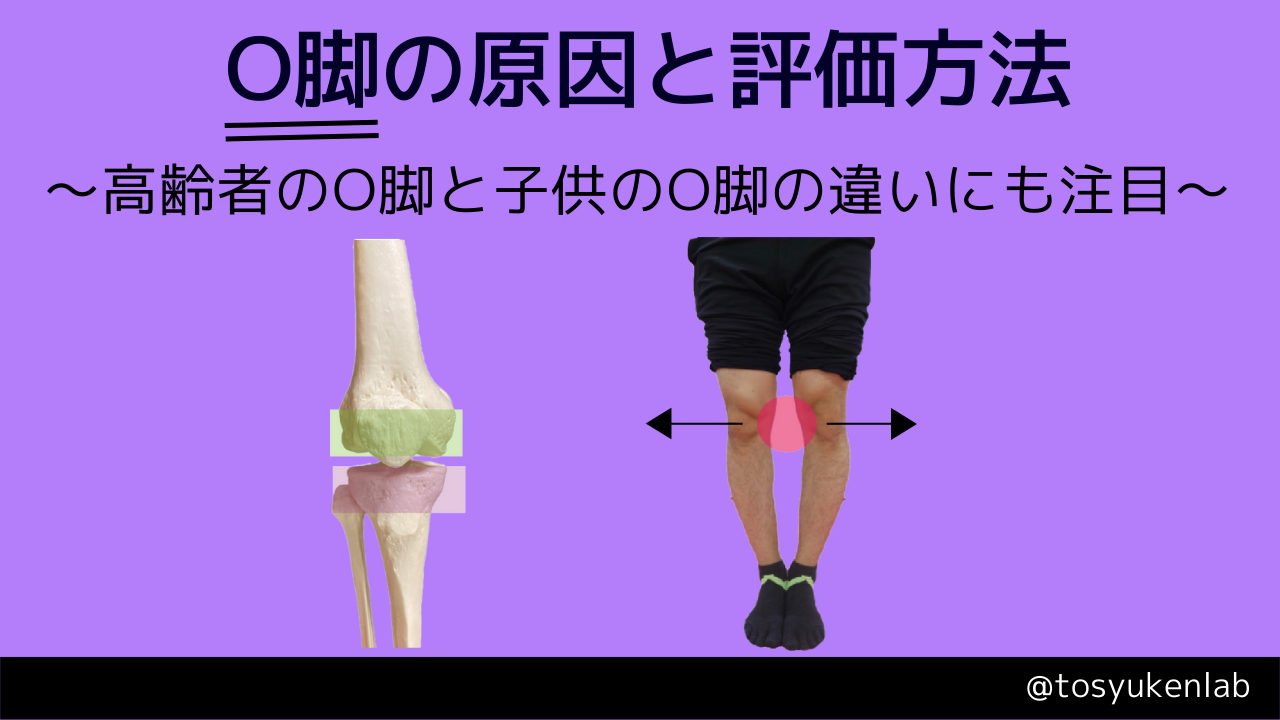 O脚の原因と評価方法 - 触診解剖ブログ