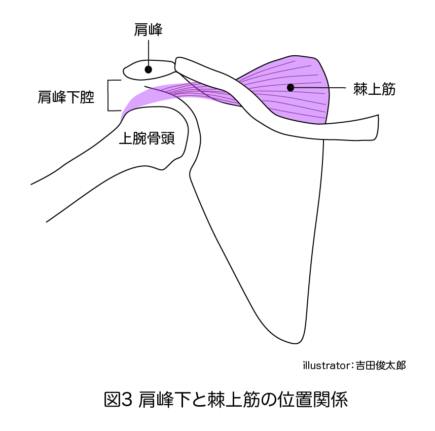 肩峰下と棘上筋の位置関係
肩峰下腔
棘上筋
肩峰
上腕骨頭