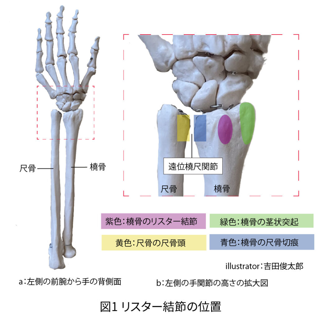 リスター結節の位置、橈骨、尺骨
橈骨の茎状突起、橈骨の尺骨切痕、尺骨頭、遠位橈尺関節