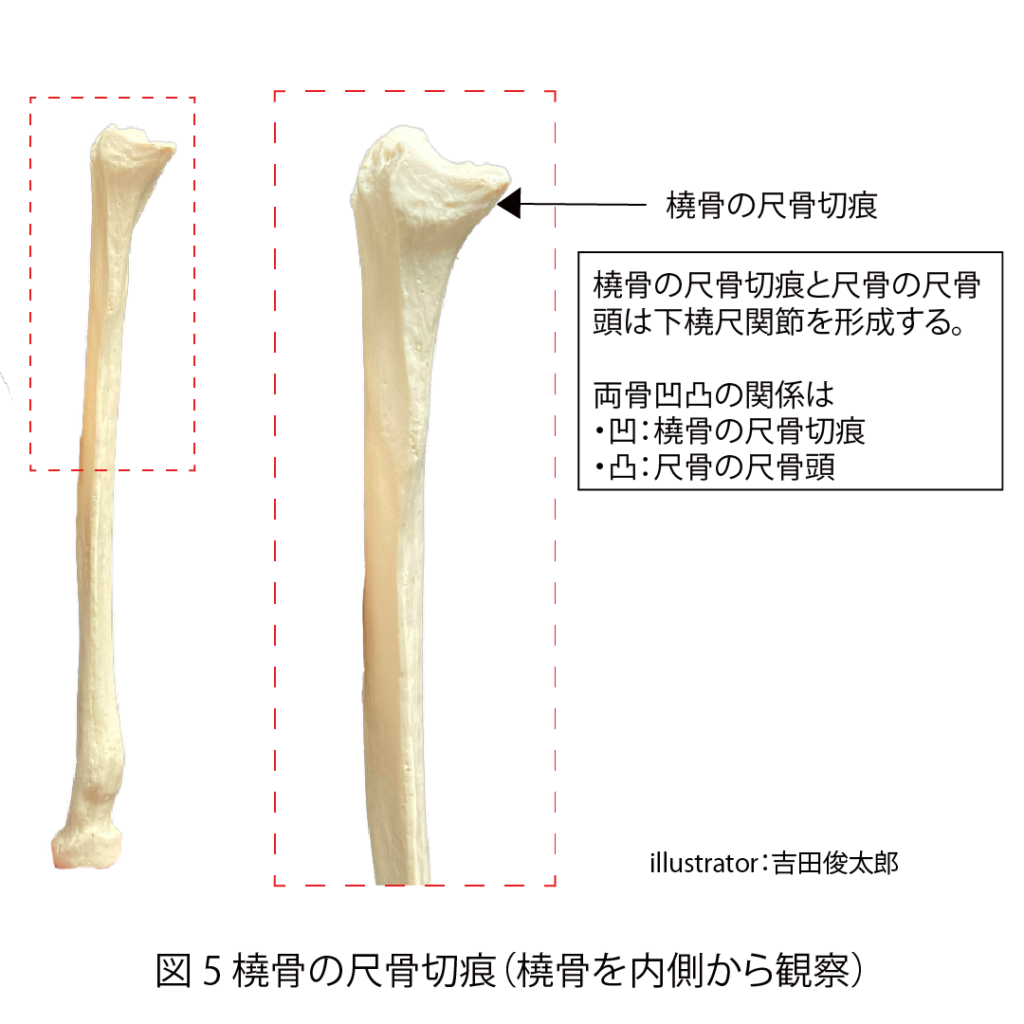 橈骨、尺骨、尺骨切痕、遠位橈尺関節