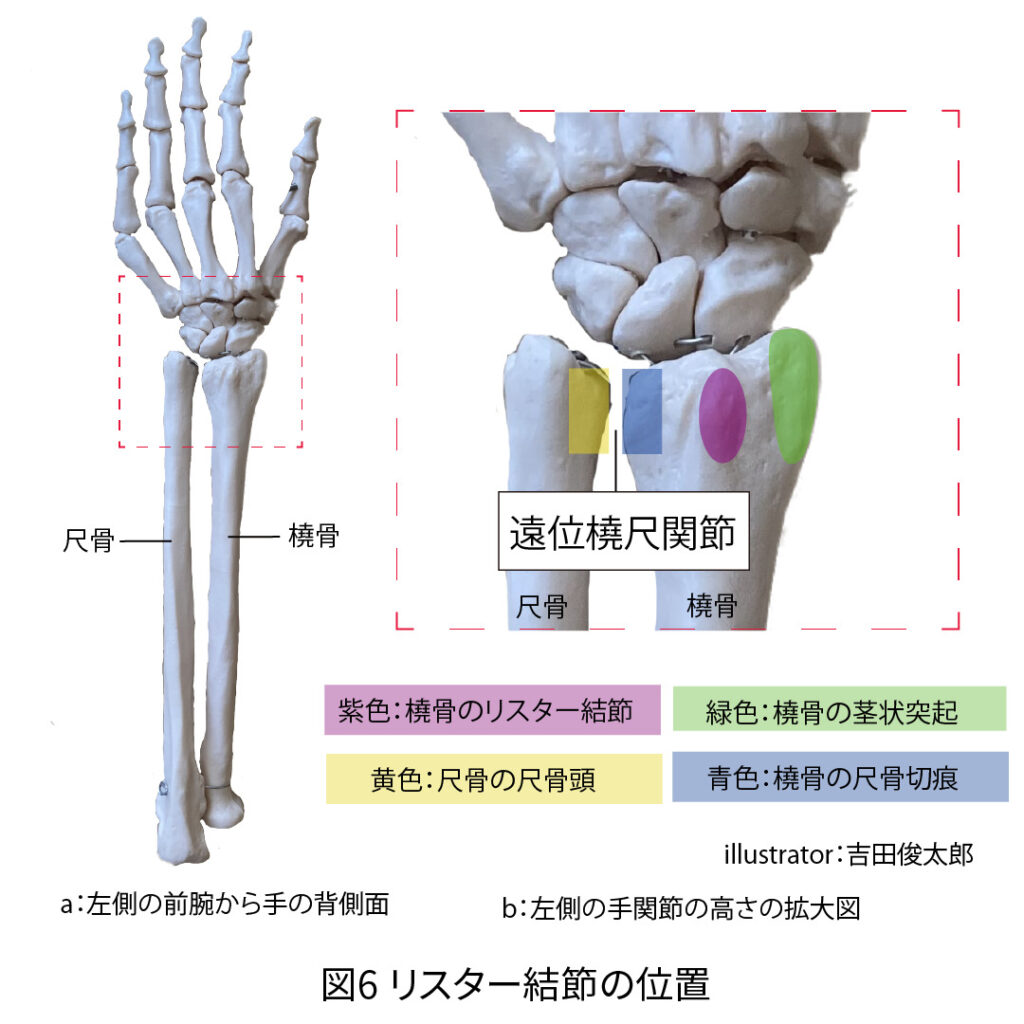 橈骨、尺骨、遠位橈尺関節、茎状突起、リスター結節、尺骨切痕、尺骨頭