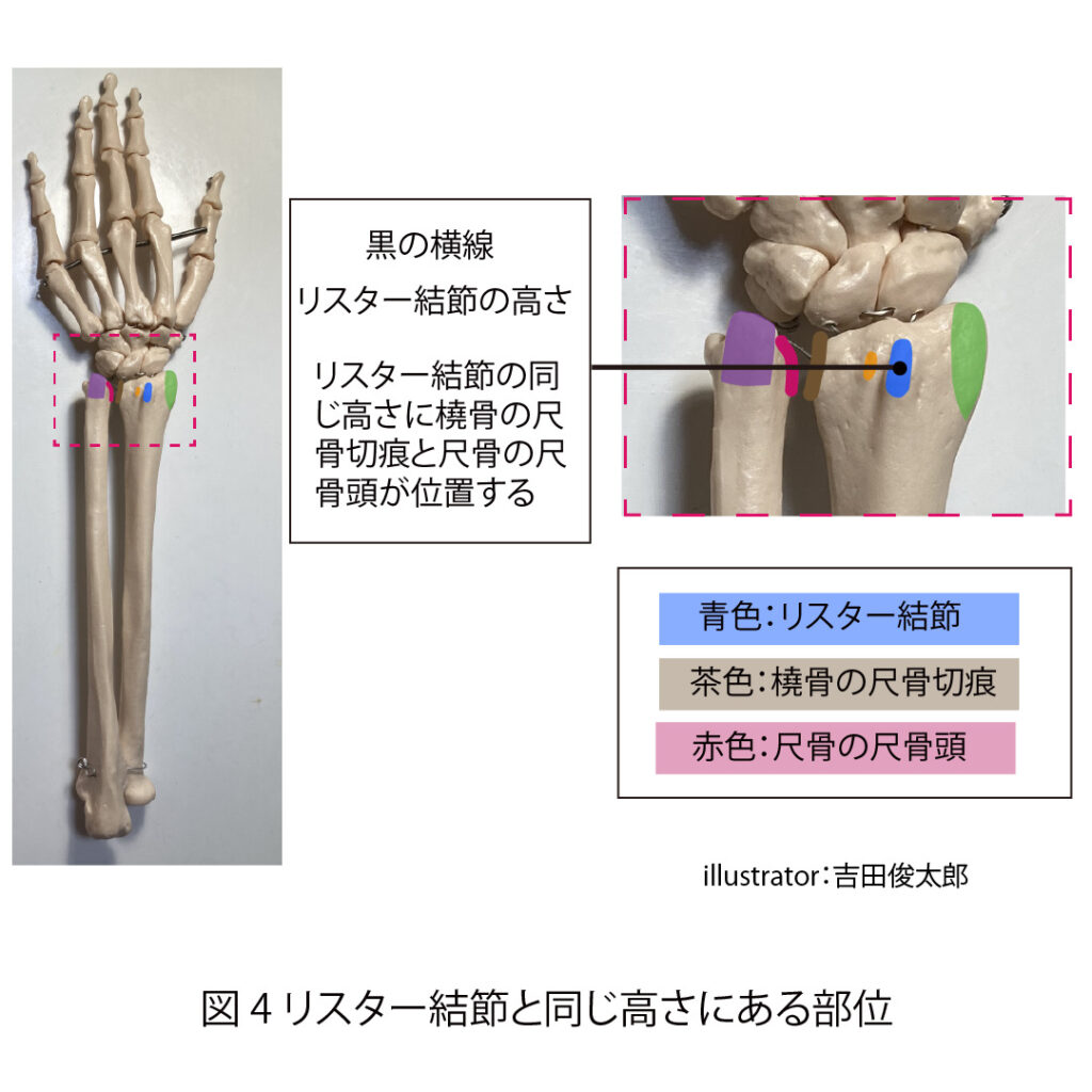 橈骨、尺骨、リスター結節、尺骨切痕、尺骨頭
