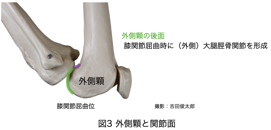 外側顆と関節面
膝蓋大腿関節
脛骨大腿関節