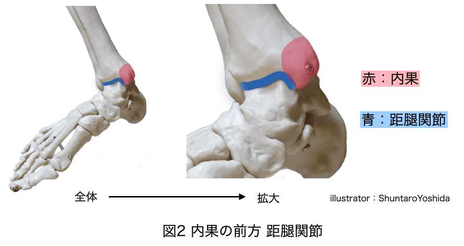 脛骨内果と距腿関節の関係
内果
距腿関節
